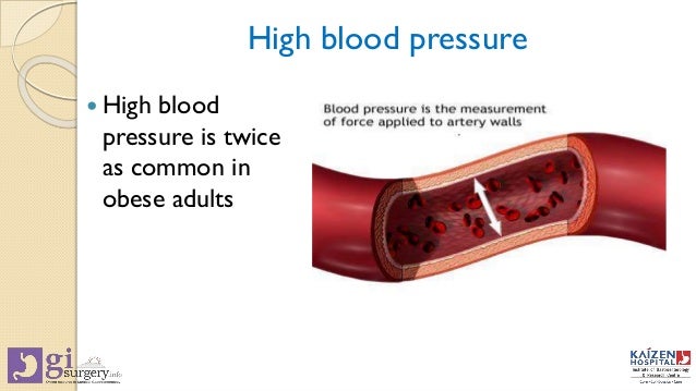 high blood pressure vs obesity How are diabetes and hypertension related being a diabetic may mean struggling with high blood pressure. high blood pressure vs obesity How are diabetes and hypertension related being a diabetic may mean struggling with high blood pressure.